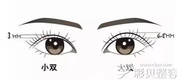 太宽的双眼皮并不好看