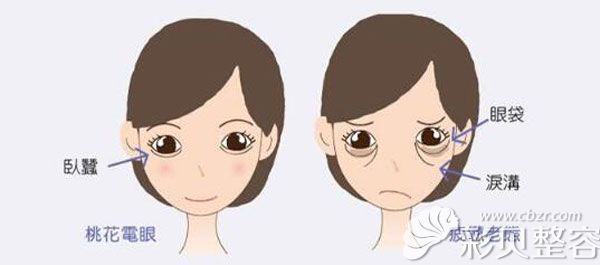 我20岁适合做外切去眼袋吗？福州海峡医生不建议这种方法