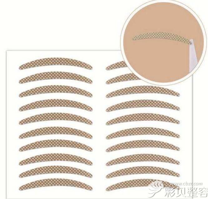 长期贴双眼皮贴会导致眼皮松弛上睑下垂