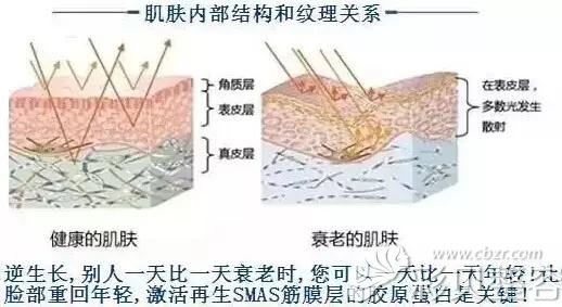 胶原蛋白的流失造成皮肤的老化 胶原蛋白的流失造成皮肤的老化