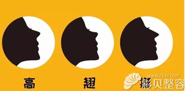 高挺翘是网红鼻的特点