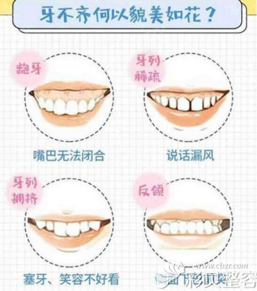常见牙齿缺陷症状