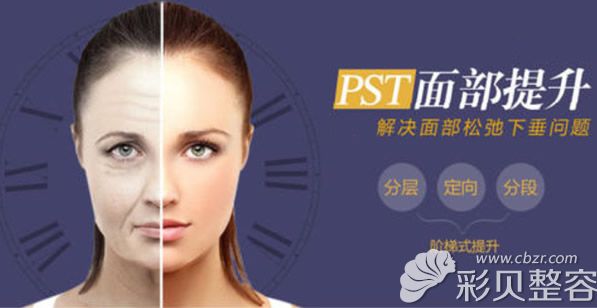 PST面部提升优势