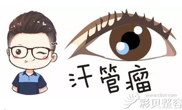 汗管瘤多发于眼部周围