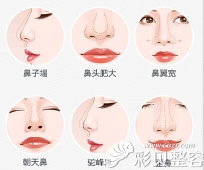 丑鼻子图片