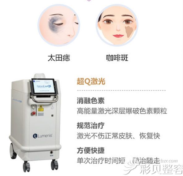 色素性胎记用超Q激光比较好