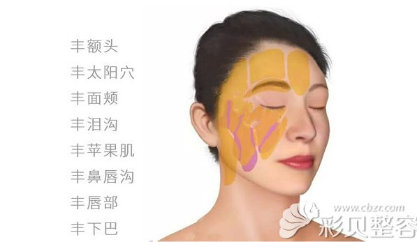 面部脂肪填充的部位