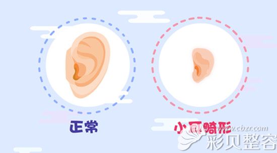 听说去韩国可以治好4岁小男孩天生的耳朵畸形，是真是假？