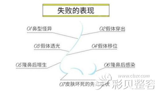 常见隆鼻失败表现症状