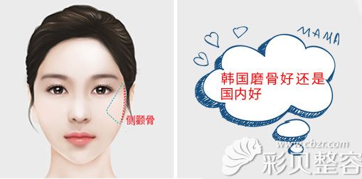 韩国和国内磨骨哪个好