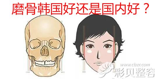 磨骨去韩国好还是国内好