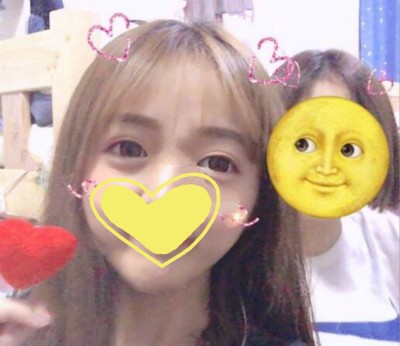 我眼综合术后4个月真实恢复期图片,诉说做眼综合花15000贵吗