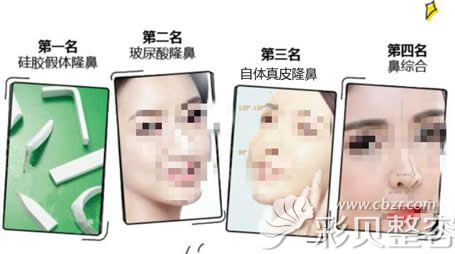 关于鼻整形网友搜索的词