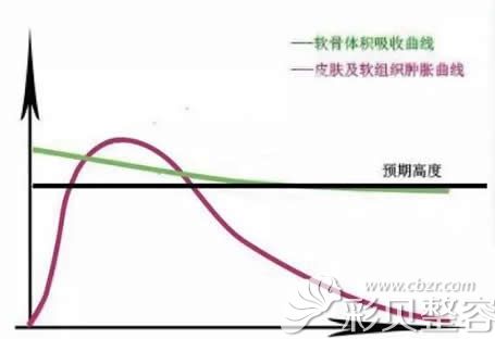 自体真皮隆鼻吸收率在20%左右