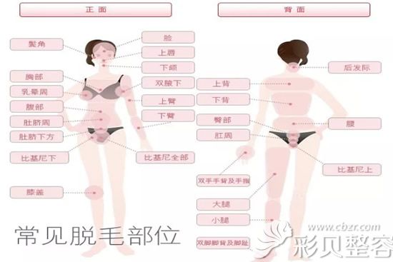 常见的脱毛部位