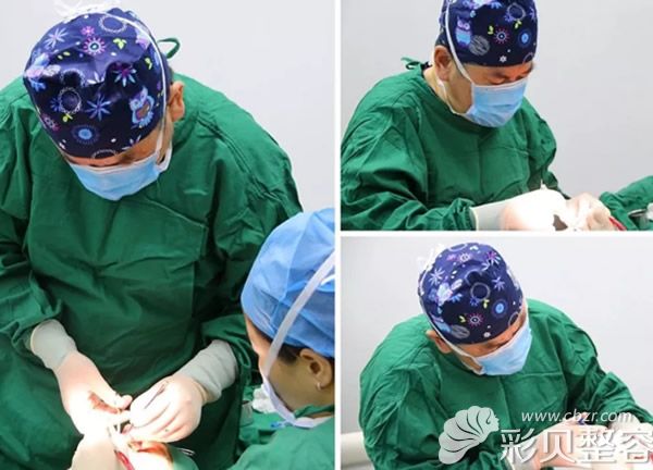 徐少骏医生正在做隆鼻手术
