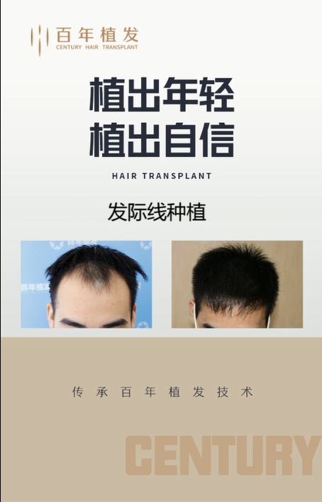 百年植发 专注头发种植