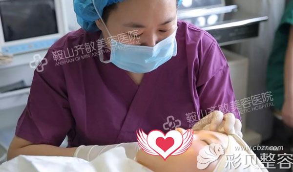 齐医生做双眼皮手术时