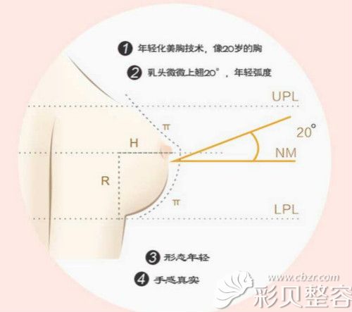 医生隆胸技术优势