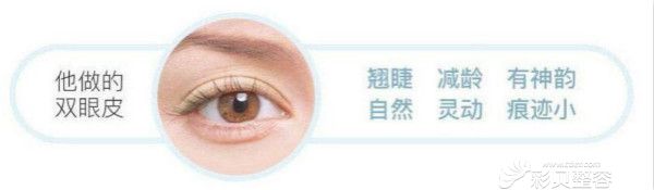 李斌医生双眼皮技术优势