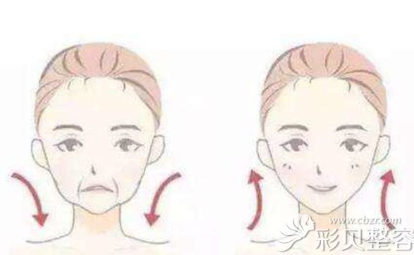 微拉美面部提升效果