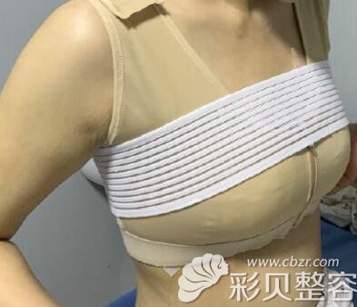 花六万做了乳房悬吊提升术真的不后悔想吐槽一下我的经历