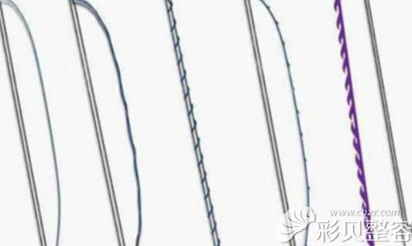 常用的埋线提升线材分螺旋线和平滑线