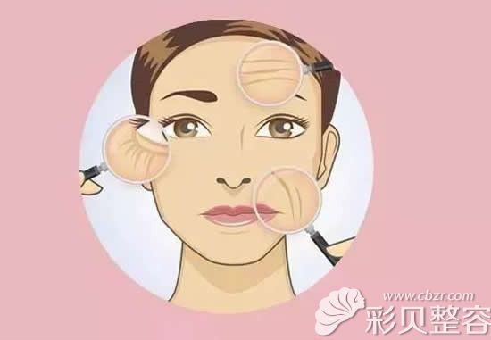 V美减龄面部提升手术是怎样的做法？恢复期会不会好痛苦？