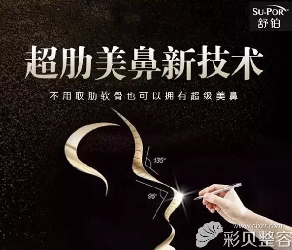 舒铂超肋是可以替代且更优于自体肋软骨的一款材料