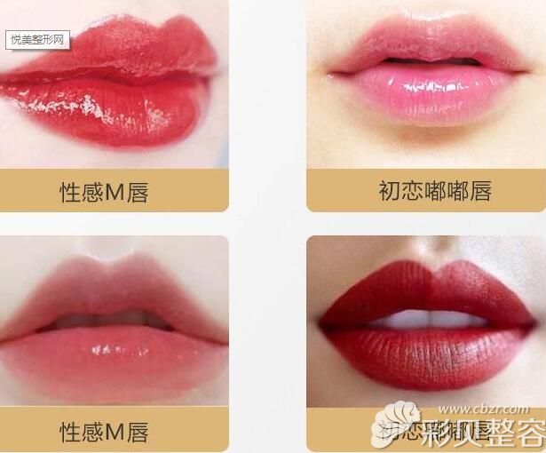 北京艾玛白馨月医生唇整形技术优势
