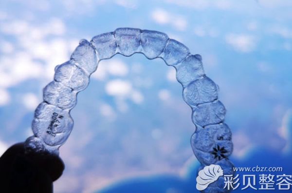 隐适美隐形牙套