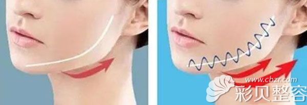 热提拉做一次能维持多久 热提拉做一次能维持多久