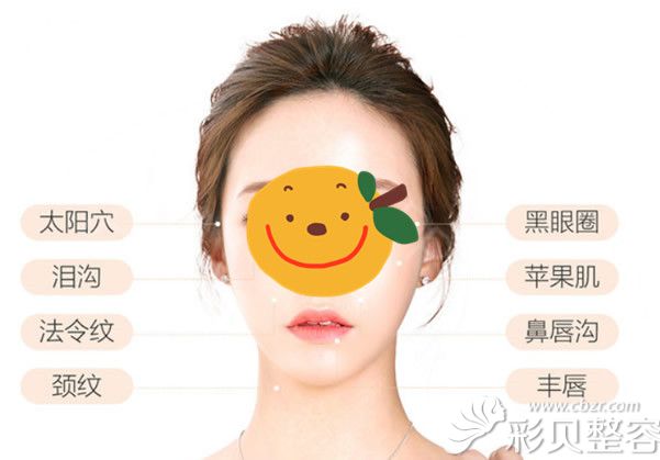 全脸脂肪填充都包括哪些部位 全脸脂肪填充都包括哪些部位