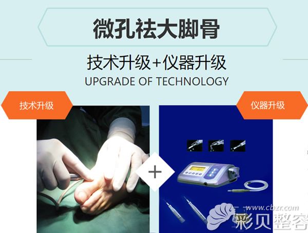 微孔祛大脚骨优势