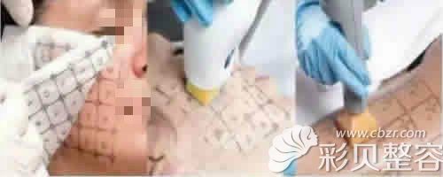 查询热玛吉真假看打印格子