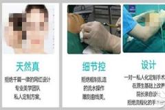 郑州哪个医生面部吸脂做的好?提供华领张涵脸部抽脂效果图