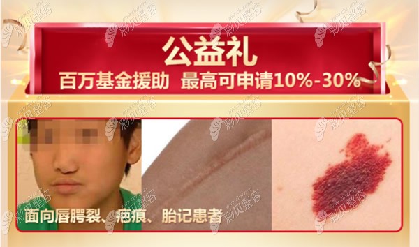 广州中家医唇腭裂修复可享受公益援助