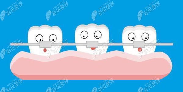 焦利敏做牙齿正畸技术优势