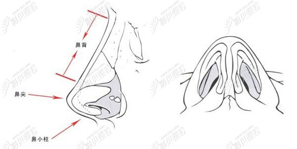 朱昊医生的隆鼻技术优势