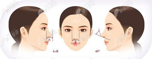 郭国祥医生做假体隆鼻技术优势