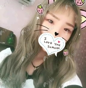 去无锡坤如玛丽医院做全切双眼皮很专业