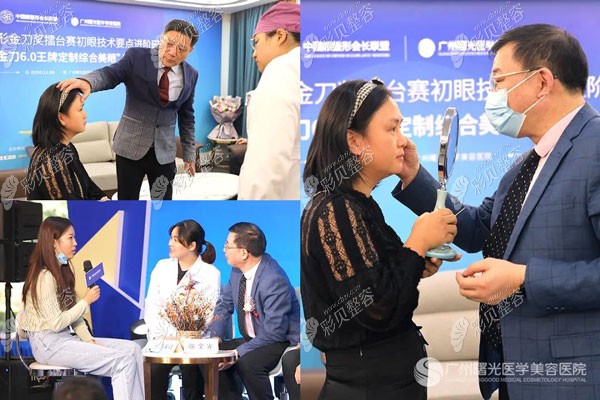 曙光整形眼整形案例公益招募