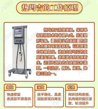 什么是热玛吉？