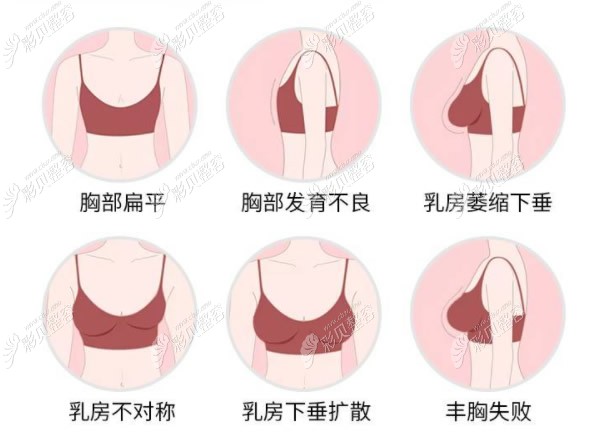 脂肪胶填充能改善哪些问题