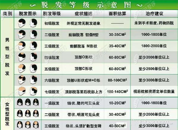 脱发等级、脱发面积及需要种植的毛囊数量示意图