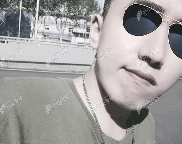 武汉亚韩医院邓正辉做鼻综合术后照