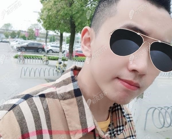 武汉亚韩整形邓正辉做鼻综合15天