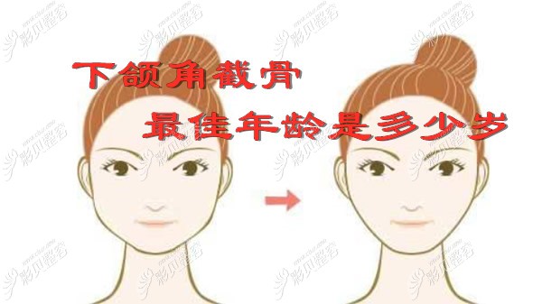 下颌角截骨适应年龄