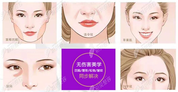 水剥离能改善眼部凹陷和眼袋吗