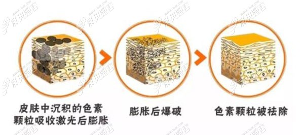 孙燕医生的祛斑优势